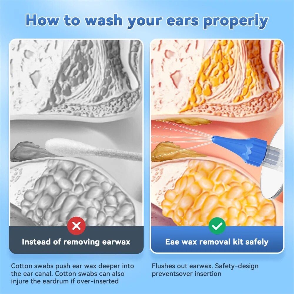 Ear Wax Removal Manual Ear Cle - Smart Garden Watering System 评论和价格