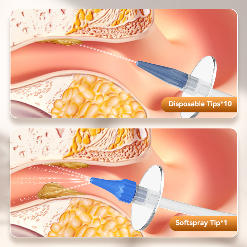 Ear Wax Removal Manual Ear Irr - Smart Garden Watering System 评论和价格